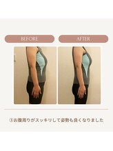 イロハナ(iro-hana)/ビフォーアフター