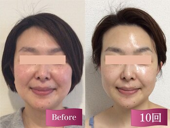 キュット(Qtto)/お肌やお顔がリフトUPするだけで