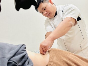 はぴねす鍼灸整骨院 天六院/鍼灸風景