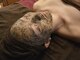 プログレス(PROGRESS)の写真/《ニキビケア実績多数◎》何をしても繰り返す大人ニキビ予防には“REVIハーブピーリング”