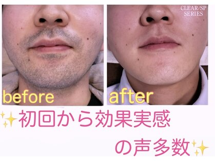 ニカ 恵比寿店の写真