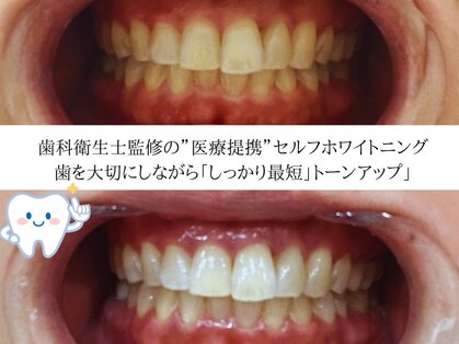 ロベリア(LoveliA)の写真