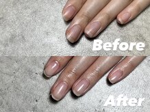 結(Yui)/自爪育成 Before→After