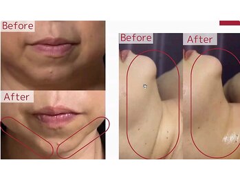 PB/レッドショット