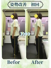 アミーゴ整体院/ビフォーアフター