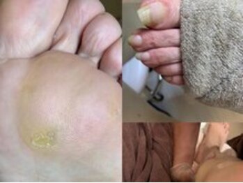 足楽 京都御池店の写真/足のお悩みは爪切り屋足楽に！豊富な知識×高い専門技術を持ったプロがあなたの足トラブルを徹底改善！