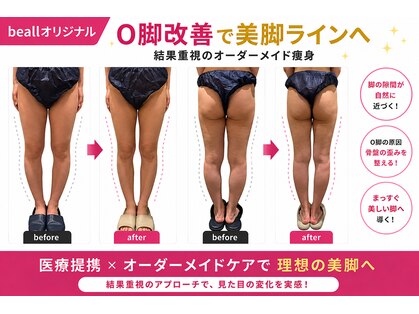 ビオール 新宿店(beall)の写真