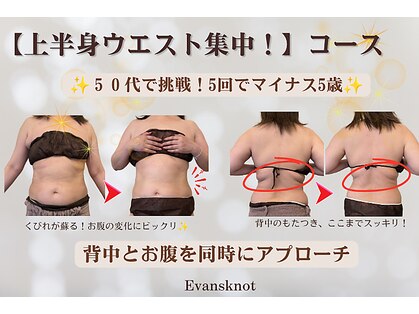 エバンス ノット(Evans knot)の写真