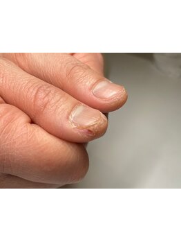 爪の悩みを解消できる（ケア含む）