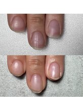 ココ(COCO)/【必見】自爪育成