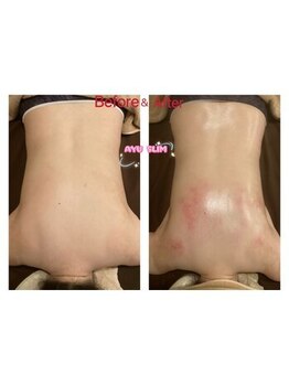 アユスリム(AYU SLIM)/一回でも変化できるの充実痩身!