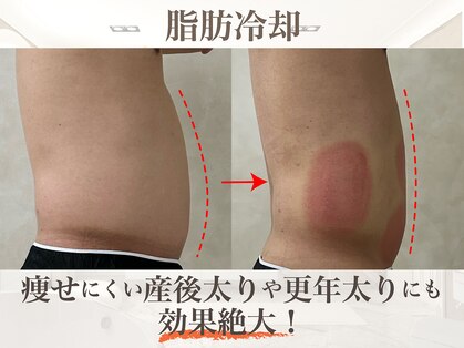 ウィボーテ(We Beaute)の写真