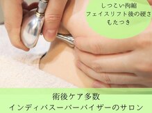 インディバ ミマリ(INDIBA ミマリ)