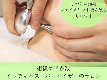 インディバ ミマリ(INDIBA ミマリ)の写真