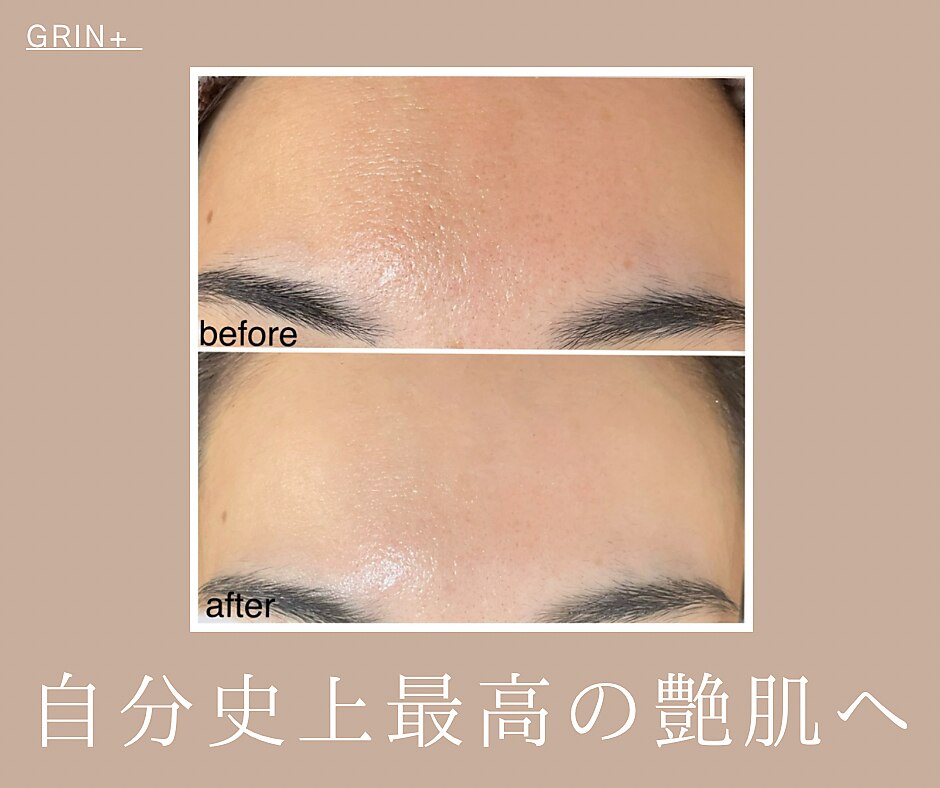 グリンプラス(grin+)｜ホットペッパービューティー