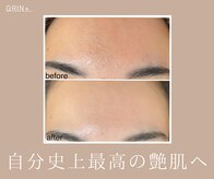 グリンプラス(grin+)