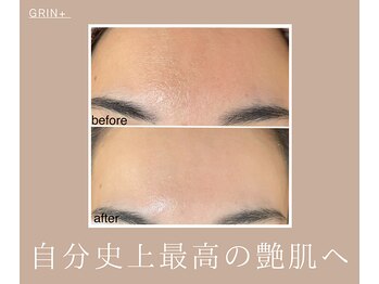 グリンプラス(grin+)