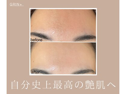 グリンプラス(grin+)の写真