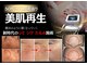 マシェリ(Ma che'rie)の写真