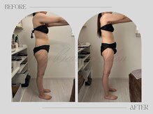 リー(Riy)/《Before and After》20代