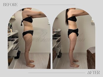 リー(Riy)/《Before and After》20代