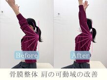 整体ヒラメント 藤沢院(Hilament)/ビフォーアフター：肩の可動域