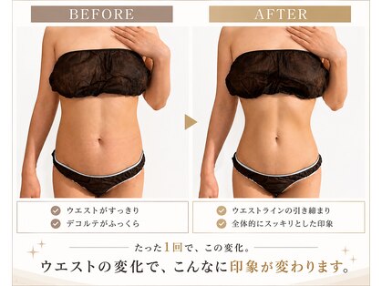 ポノ インディバ サロン(pono. Indiba salon)の写真