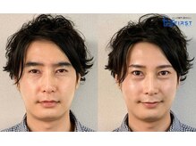 ファースト 京都店/自然/平行/アーチ/角眉/京都