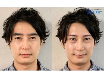 ファースト 京都店/自然/平行/アーチ/角眉/京都