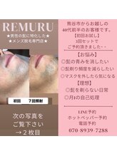 リムル(REMURU)/20代前半のお客様　髭脱毛7回目
