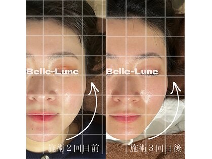 ベルルーナ(Belle-Lune)の写真