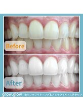 グロウ グロウ(grow.glow)/