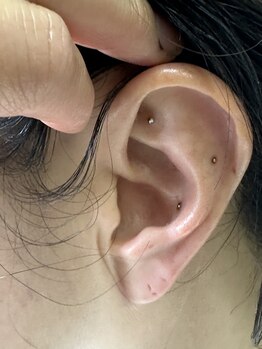 ぽの整骨院/耳ツボ