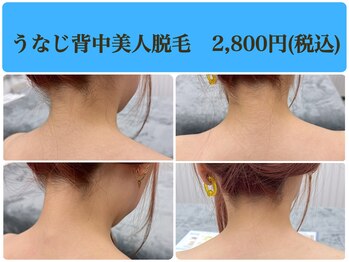 アロンジェファム(allonge femme)/【うなじ～背中上部】脱毛