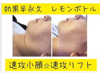 ルナ(Luna)/大人気!レモンボトル