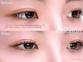 エレット 茗荷谷店(ERETTO)/ &Healthyアンドヘルシー 100本