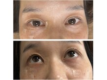 シゼン(Shizen)/眼球をしっかり動かします