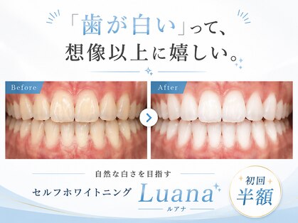 ルアナ(Luana)の写真