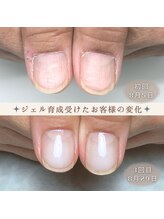 ジェル育成3回目