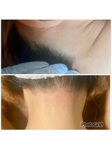 マイレ 銀座(MAILE)/うなじ