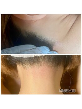 マイレ 銀座(MAILE)/うなじ