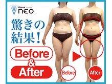 ウィズリリナ 新横浜(with Lilina.)/痩身/蓄熱式超音波/新横浜