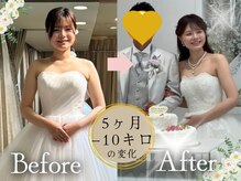 スリムプロ 天王寺店(Slimpro)/ブライダルエステ☆