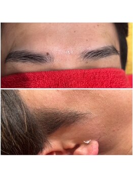 パーツ脱毛のできるサロン