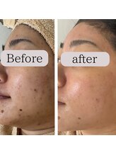 エリンダ(E LINDA)/VOSサロンケア