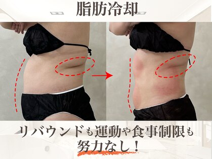 ウィボーテ(We Beaute)の写真