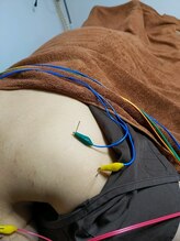 乃々鍼灸整体院 表参道/肩こり、肩関節施術