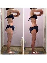 ナレル(narrel)/(新潟市/骨盤/痩身/ダイエット)