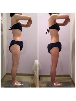 ナレル(narrel)/(新潟市/骨盤/痩身/ダイエット)