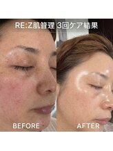 順蘭堂/韓国肌管理RE:Z